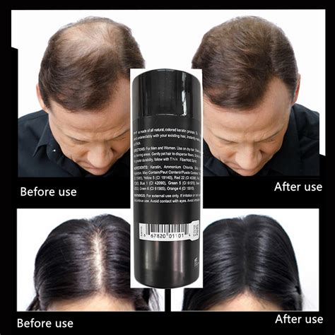 Black Magic Hair Fibers: A Quick Fix for Thinning Hair